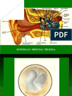 Otitis Media Komplikasi