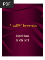 Right Ventricular Infarction - LITFL - ECG Library Diagnosis | PDF ...