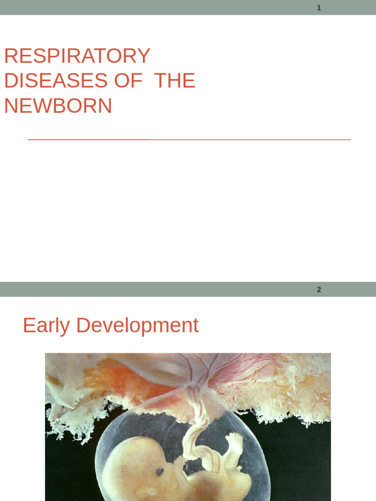 Respiratory Distress Syndrome | PDF | Lung | Pneumonia