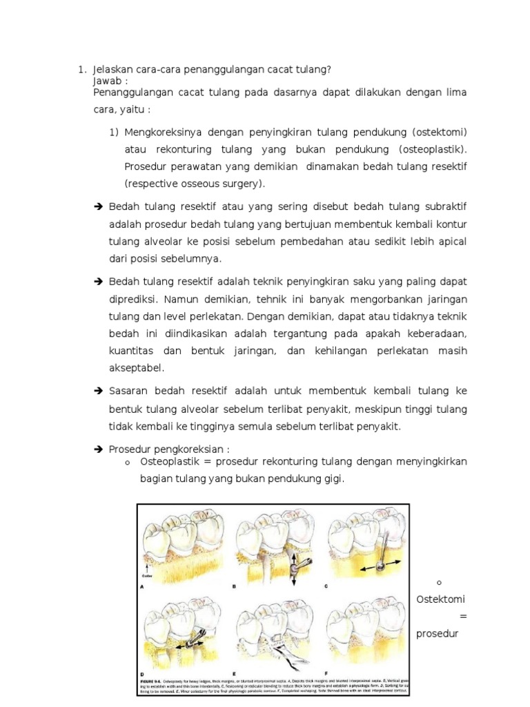 Penanggulangan Cacat Tulang Periodontal | PDF