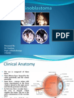 Retinoblastoma Drvandana 120403110900 Phpapp01