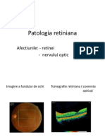 patologia retiniana