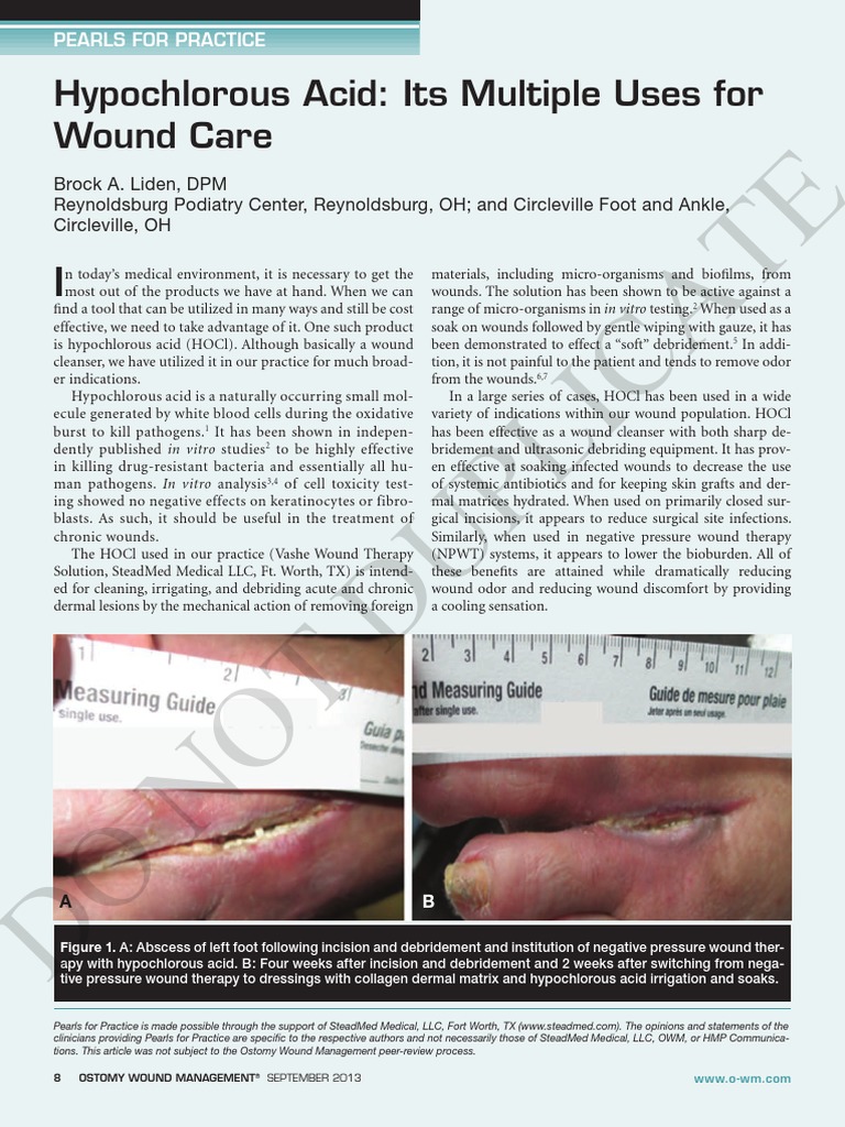 Hypochlorous Acid Its Multiple Uses for Wound Care Wound Medical