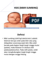 Cleft Lip (Bibir Sumbing)