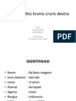 Osteomielitis Kronis Cruris Dextra