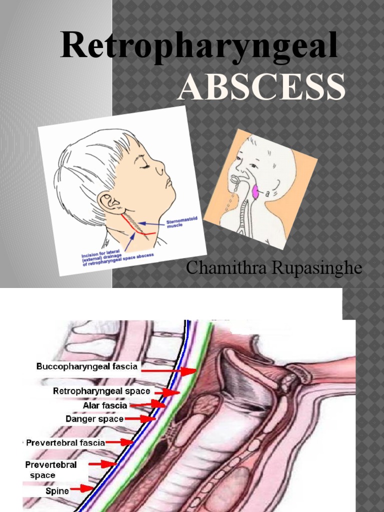 Abscess | PDF | Human Head And Neck | Human Anatomy