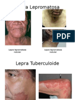 Lepra e Infecciones Producidas Por Virus