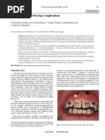  Oral and Perioral Piercing Complications