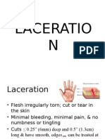 Laceration (Aeron Lamsen)