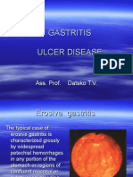 6 Gastritis