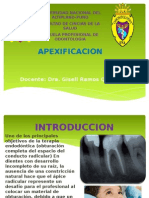 Apexificacion