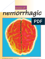 Download haemorrhagic stroke by lengkong SN25297449 doc pdf