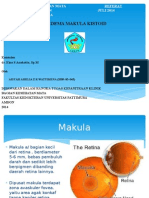 Edema Makula Kistoid Referat