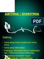 ARITMIA