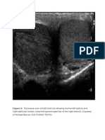 Understanding Megalopenis and Macrophallus | PDF | Androgen | Medical ...