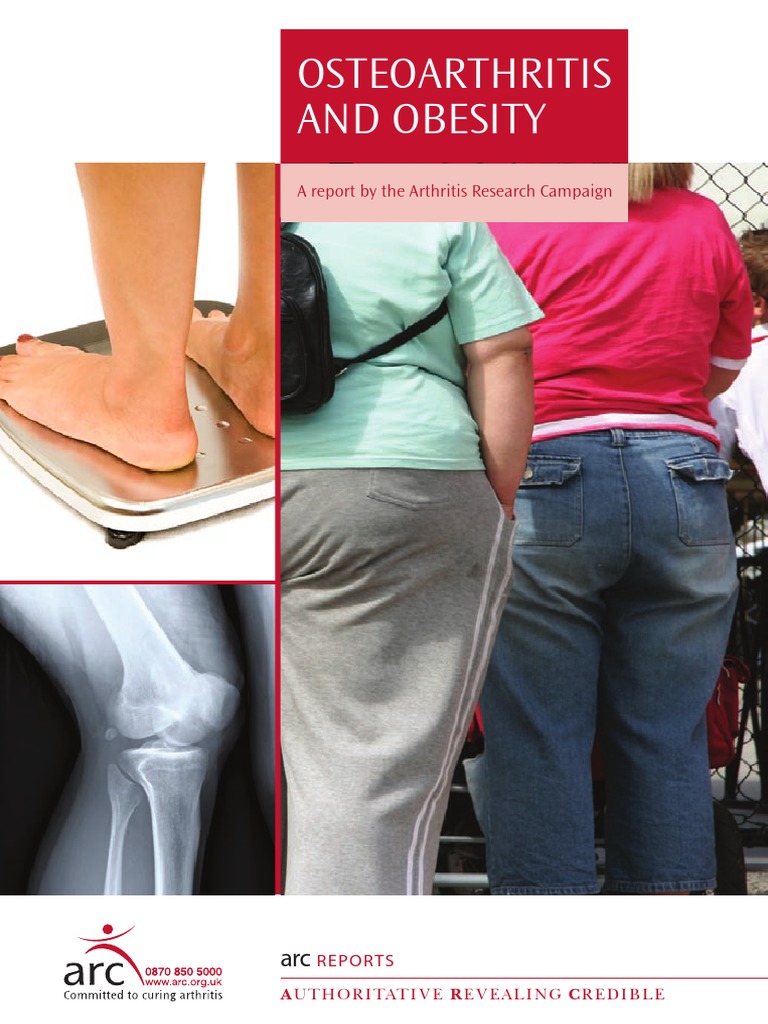 ARC Report Osteoarthritis Obesity Osteoarthritis Obesity