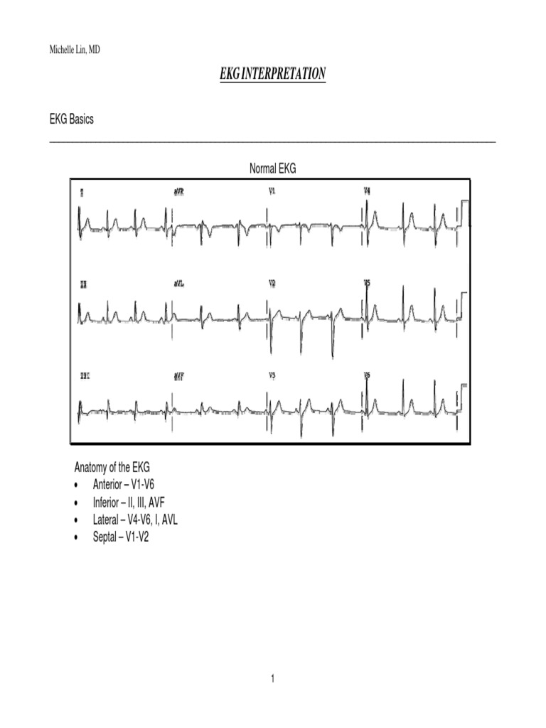 EKG Interpretation Basics and Cases | PDF | Electrocardiography ...