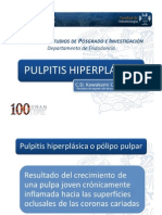 Pulpitis Hiperplasica Sep 2011