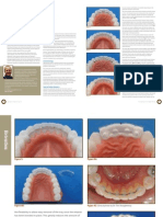 retainer lingiual bonded fixed.pdf