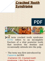The Cracked Tooth Syndrome