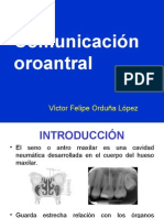 Comunicación oroantral