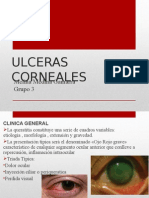 Ulceras Corneales