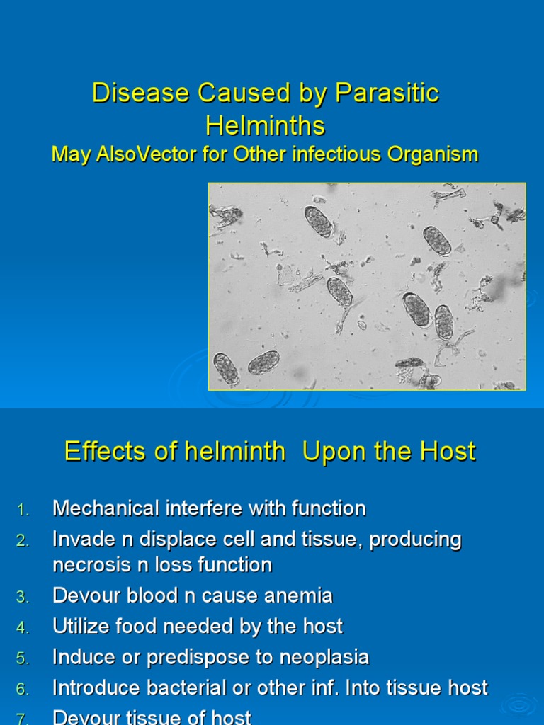 Helminth.ppt Immune System Inflammation