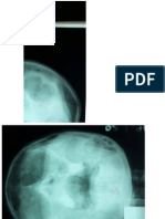Radiologi Thorax Normal Foto Waters Pptx Gambar