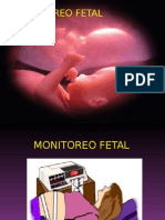 Monitoreo Fetal