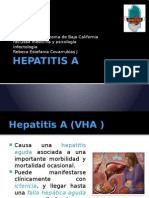 Hepatitis A