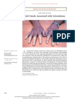 Cold Hands Associated With Scleroderma: Images in Clinical Medicine
