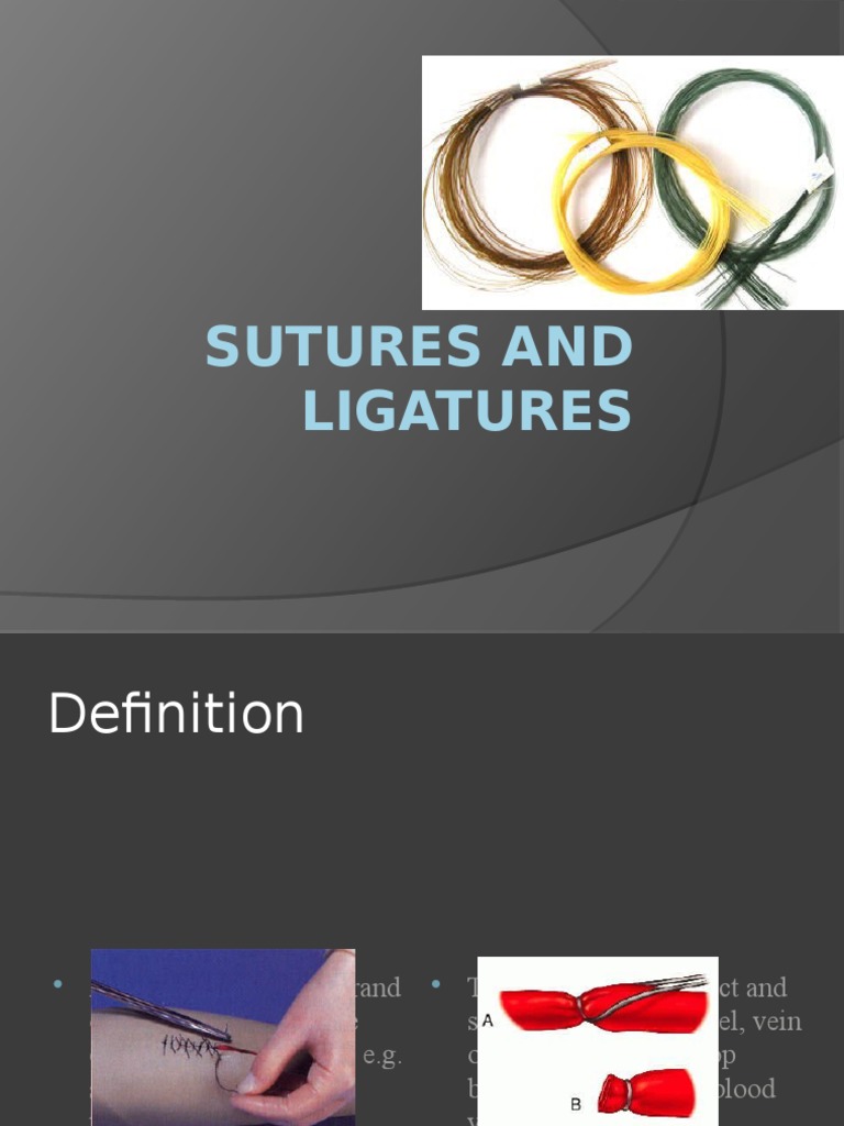 Sutures and Ligatures PDF Surgical Suture Sterilization (Microbiology)