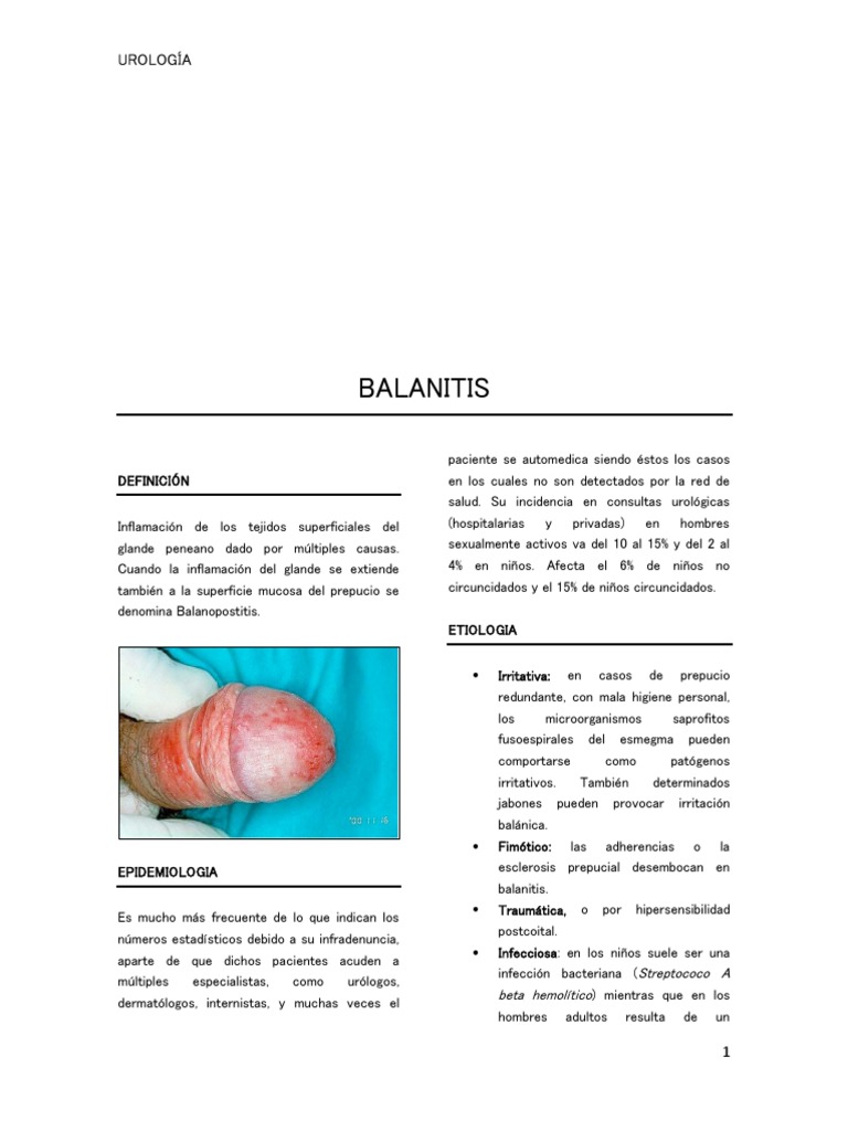 Balanitis: Causes, Symptoms, Complications, – DLYG