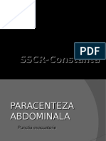 Paracenteza