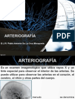 Arteriografia