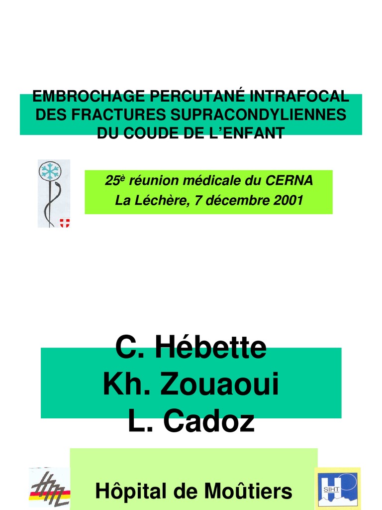 Embrochage Percutané Intrafocal Des Fractures Supracondyliennes Du ...