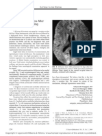 Anterior Ischemic Optic Neuropathy