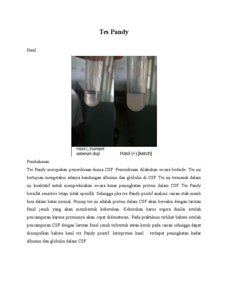 Tes Pandy untuk Analisis CSF | PDF | Kesehatan Holistik