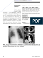 Failure of Central v.catheterisation