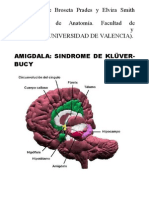 Sindrome Kluver