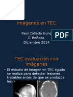 Imágenes en TEC. 