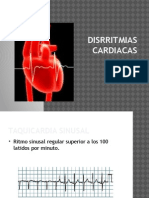 Disrritmias Cardiacas