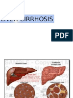Liver Cirrhosis Liver Cirrhosis