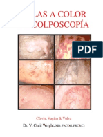 Atlas de Colposcopia