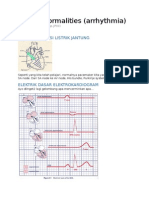 ECG Abnormalities