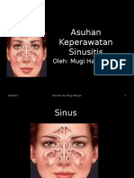 Askep Sinusitis