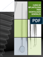 Curso Implantes