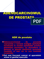 Adenocarcinomul de Prostata