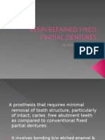 Resin Retained Fixed Partial Dentures