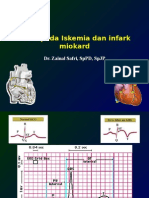 EKG ACS 2 .pptx